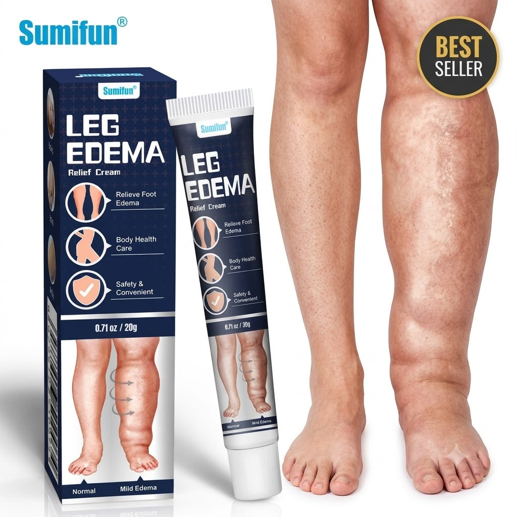 Leg edema