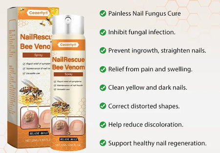Spray anti mycose des ongles