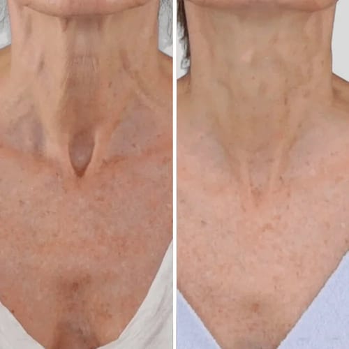Qinglin – Le secret d’un regard frais et d’une peau rajeunie